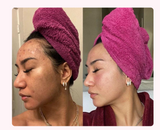 🔥100% Organic 🔥 Kojic Acid & Turmeric Soap 🔥Buy 1 Get 1 Free 🔥